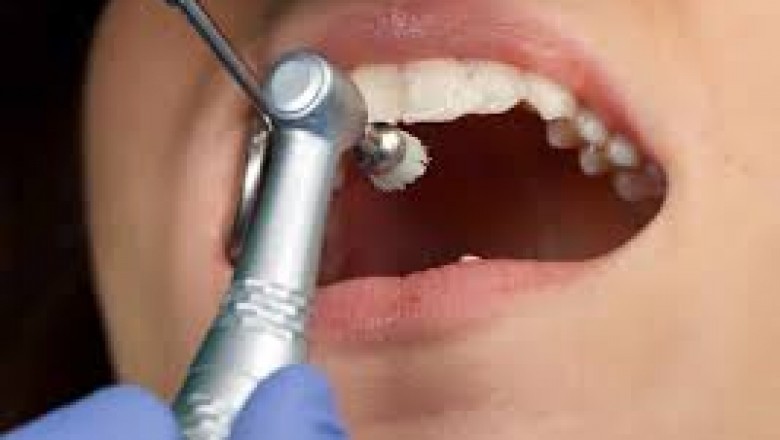 Family dentist Lewis Center