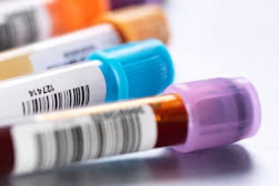 Why Is Home STD Test Kits The Best For STD Testing