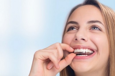 10 Advantages of Invisalign