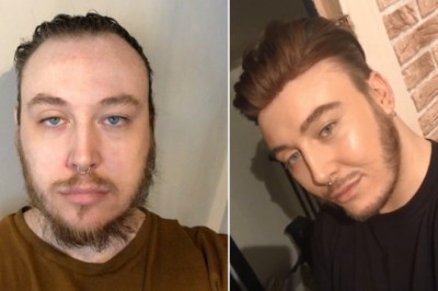 How to deal with oily skin while wearing a men's hair system