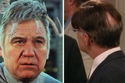 Can A Toupee Look Real