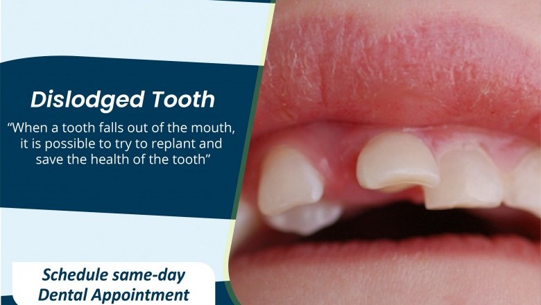 Dislodged Tooth | Emergency Dental Services in United States