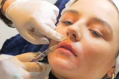 Find the Best Skin Clinic in London for Skin Treatments