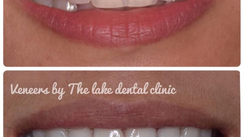 Issues to think about for Acquiring a fantastic Dental Clinic