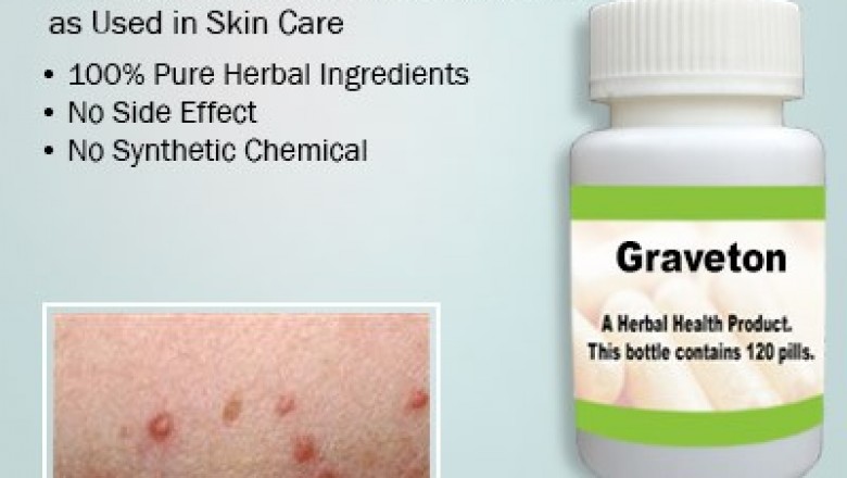 Natural Remedies for Grover’s Disease Causes and Treatment