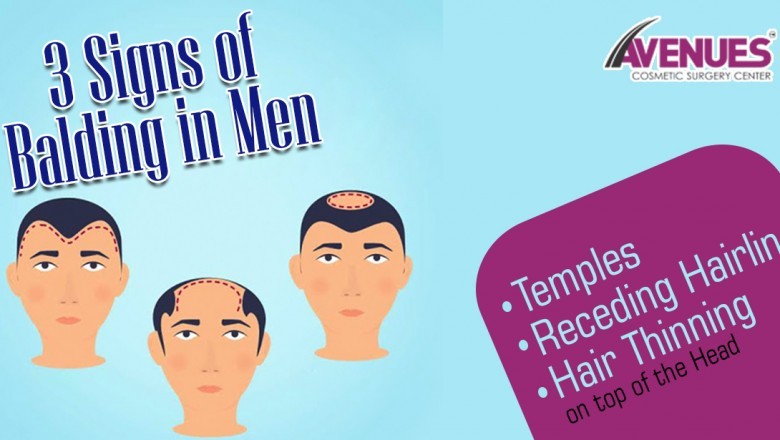Factors Affecting The Cost Of Hair Transplant