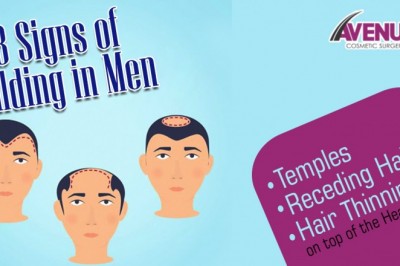Factors Affecting The Cost Of Hair Transplant