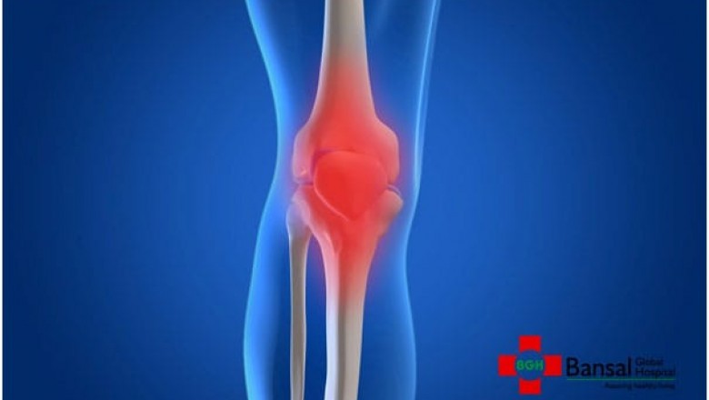 Best Orthopaedic Doctor in Delhi | Bansal Global Hospital
