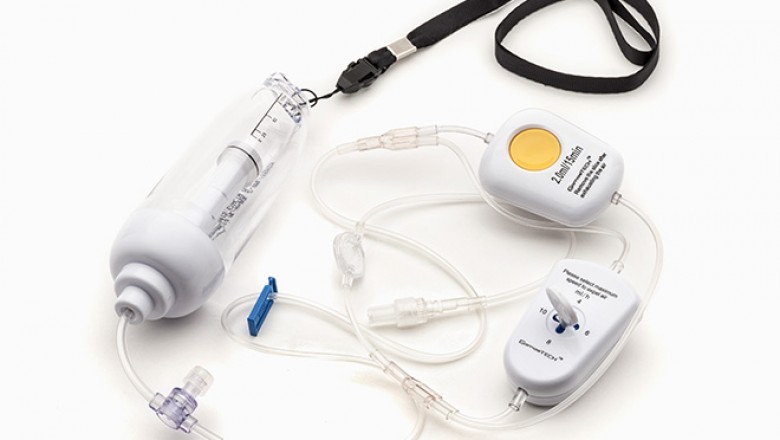 Elastomeric Infusion Pumps are gaining Massive Popularity in Medical Field with  Applications