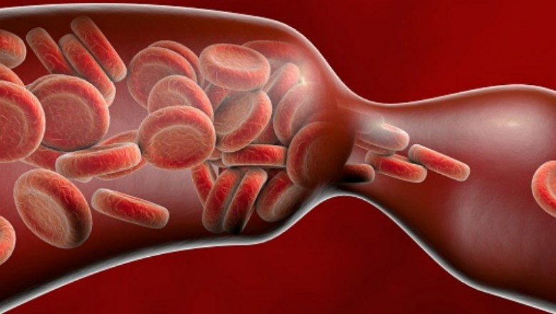 Increasing Prevalence of Venous Thromboembolism to Augment Growth of the Venous Thromboembolism (VTE) Market