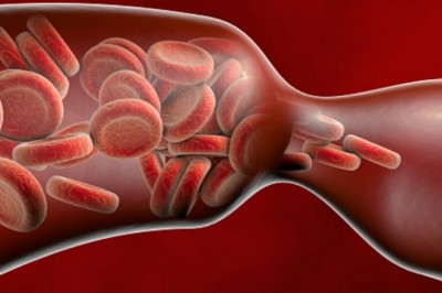 Increasing Prevalence of Venous Thromboembolism to Augment Growth of the Venous Thromboembolism (VTE) Market