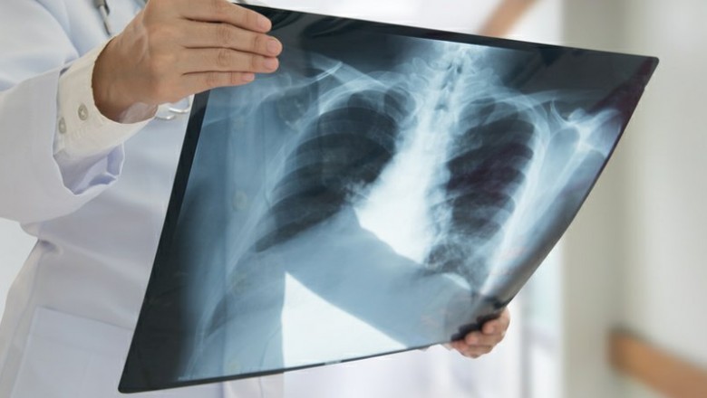 Here Is What No One Tells You about X-ray Security Scanner