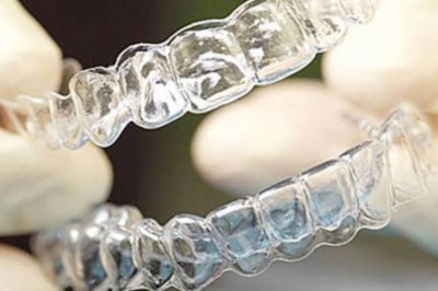 Clear Aligners Market To Surpass US$ 7.2 Billion By 2026 - Coherent Market Insights