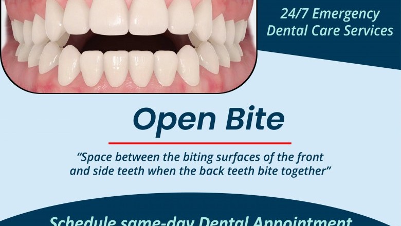 Open Bite Treatment | Emergency Dentist 24/7