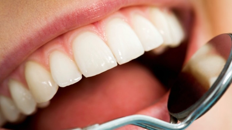Dental Videos