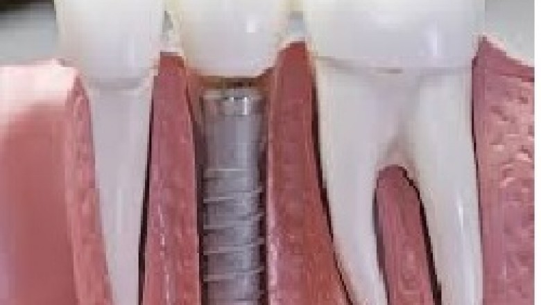 Dentist in Malden MA