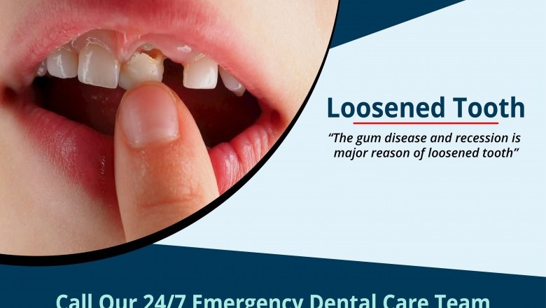 Loosened Tooth Treatment | Urgent Dental Care