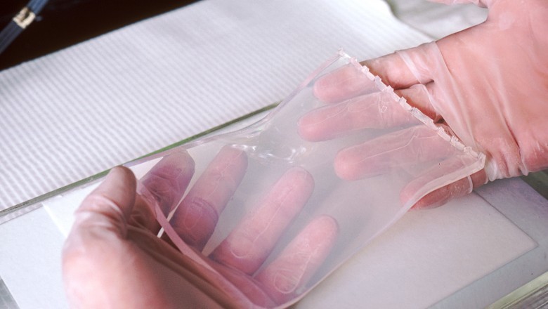 Southern Blotting Plays an Important Role in Various Healthcare Industry Verticals