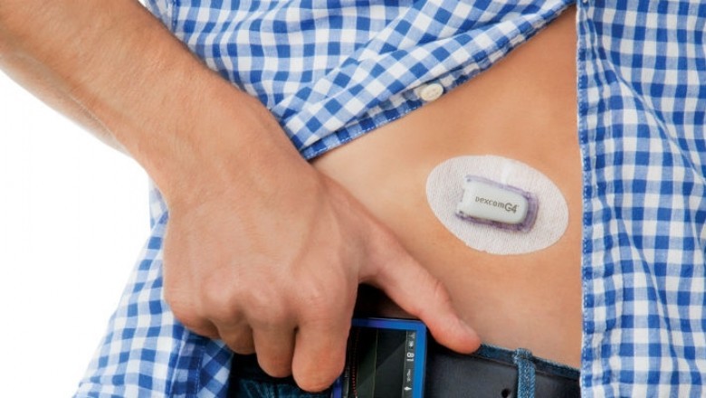 Continuous Glucose Monitoring Systems Market Global Research Analysis Report and Clinical Outlook 2021 to 2030