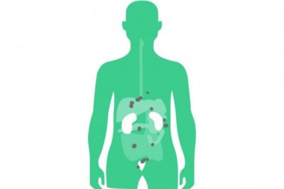 Theranostics, a change from conventional medicine to a new approach to personalized and precision medicine