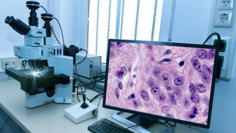 Digital Pathology Market Clinical Research Analysis with Latest Technology Advancements in Healthcare to 2030