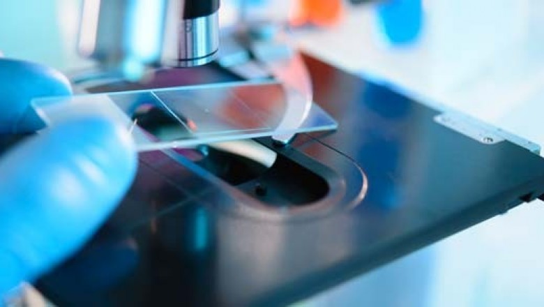 Infectious Disease Diagnostics Market Size Share Trends Forecast 2026