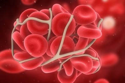 Antithrombin; an important blood clotting proteinase anticoagulant regulator
