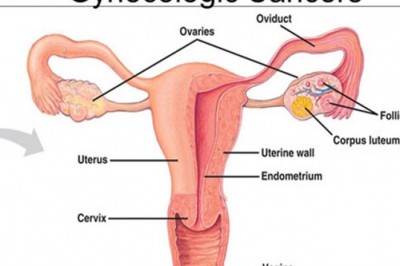Different companies concentrate on AI-driven, patient-centered R&D platforms for gynecological cancer drugs