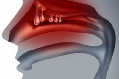 Treatment for nasal polyps involves surgeries and medications to treat nasal polyps that may range from normal to serious to cancerous