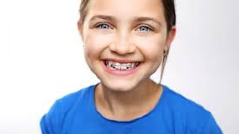 Crooked Teeth - Causes and Treatment