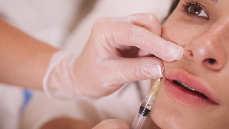 How Lip Fillers Can Benefit You Big Time?