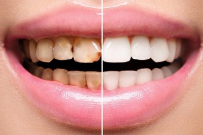 Cosmetic Dentistry Market Size Share Trends Forecast 2026