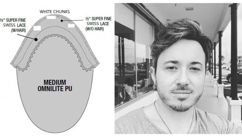 Best custom made hair replacement systems online