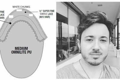 Best custom made hair replacement systems online