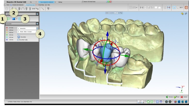 Dental CAD or CAM Materials and Systems Market Global Size, Trends and Research Analysis to 2030