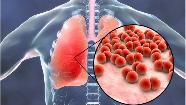 The advent of Covid-19 increases the importance of Pneumonia Diagnosis, resulting in increased demand for Pneumonia Testing
