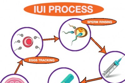 Which One Should You Opt For - IVF Or IUI?