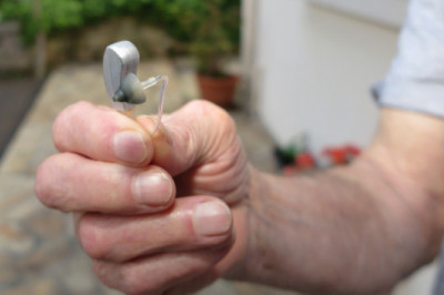 Cochlear implants, bone-anchored hearing systems, and FM systems are examples of audiology devices that can be used to diagnose and treat ear problems