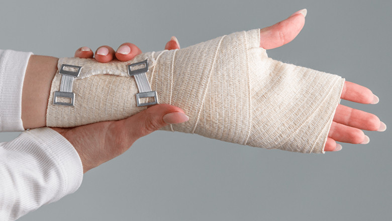 All About Carpal Tunnel Syndrome