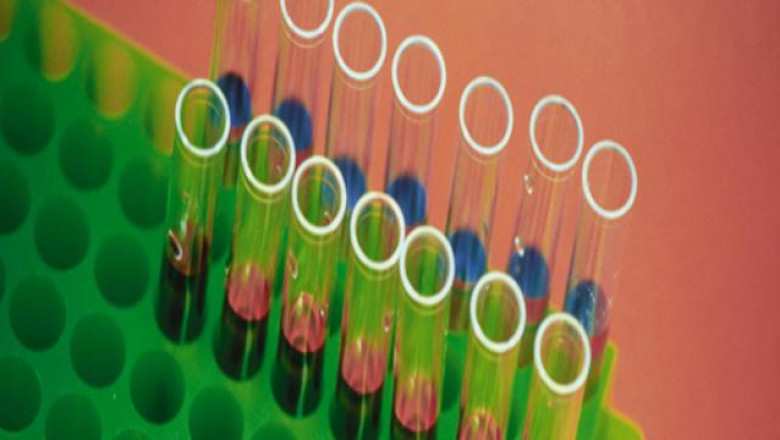 Covid-19's Arrival Will Hasten the Adoption of Protein Assays Market for Detecting Antibodies to Coronavirus Proteins
