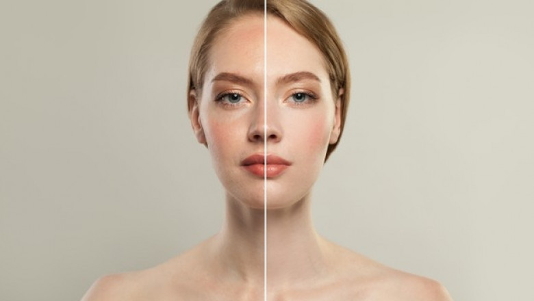 what is olive skin undertone and tips for skin undertone