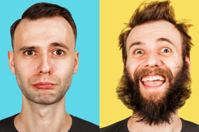 Restore Your Beard, Sideburns with a Facial Hair Transplant
