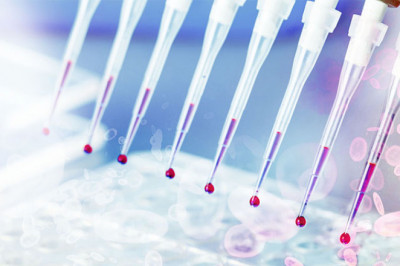 Blood screening tests have become increasingly important in the diagnosis of a wide range of diseases, such as HIV/AIDS, high cholesterol, and cancer