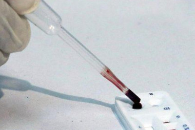 Diagnostics for Influenza: A look at the various testing options and how they can help doctors treat patients more effectively.