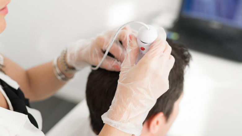 Best Hair Transplant in London