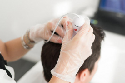 Best Hair Transplant in London