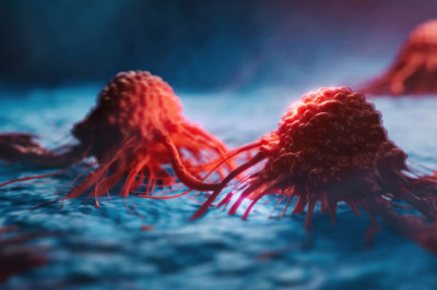 What is tumor/cancer profiling? What are the different kind of profiler utilized simultaneously?