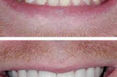 General Dentistry Services