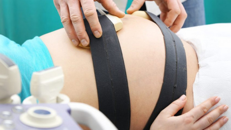 Fetal Monitoring Market Size, Share, Outlook, and Opportunity Analysis, 2018– 2026