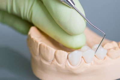 Dental Bridges Treatment at Your Tanglewood Houston Dentist